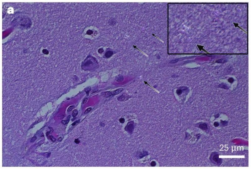 Egy teáskanálnyi műanyag is elegendő lehet ahhoz, hogy az emberek gondolkodását és viselkedését megváltoztassa.